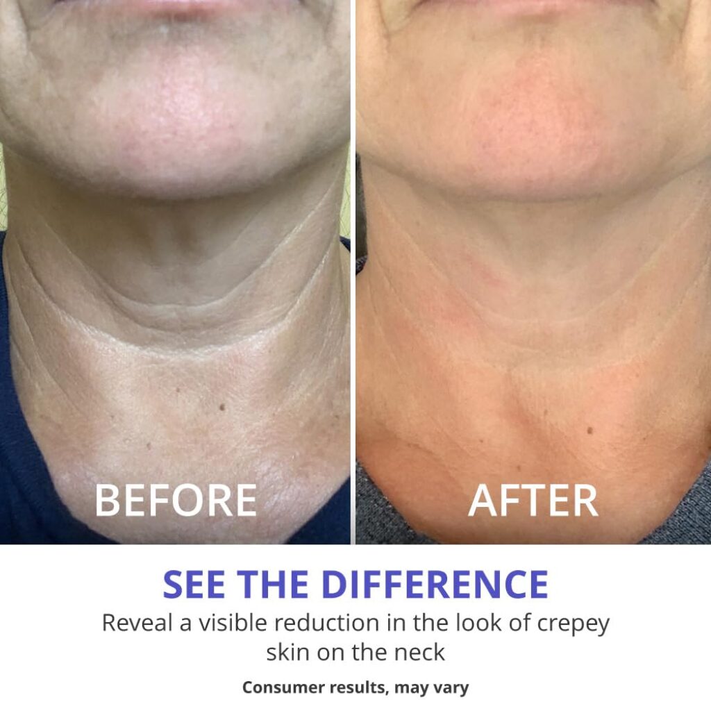 best neck firming cream, neck firming cream, best products for neck firming, highest rated neck firming cream, best neck firming cream dermatologist recommended, what is the best neck firming cream that really works, best firming neck cream, best product for firming neck, firming neck cream